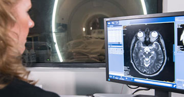 Magnetic Resonance Imaging (MRI)