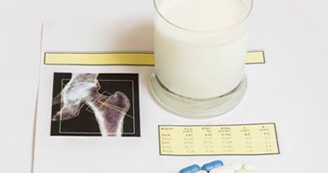 Bone Densitometry (DXA)